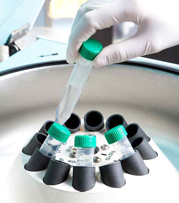 Mutation analysis by MLPA/TP-PCR